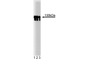 Western blot analysis of p130 [Cas] on a human endothelial cell lysate. (BCAR1 antibody  (AA 644-819))