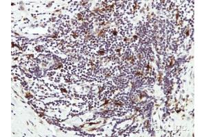 IHC-P Image Immunohistochemical analysis of paraffin-embedded Human lymph tissue, using HICE1 , antibody at 1:50 dilution.
