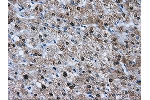 Immunohistochemical staining of paraffin-embedded pancreas tissue using anti-HDAC10mouse monoclonal antibody. (HDAC10 antibody)