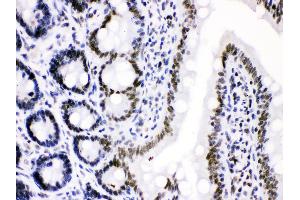 Anti- Cdk9 Picoband antibody, IHC(P) IHC(P): Rat Intestine Tissue (CDK9 antibody  (AA 141-372))