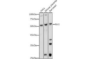 Western blot analysis of extracts of various cell lines, using ELK1 antibody (ABIN1679704, ABIN3015328, ABIN3015329 and ABIN6213987) at 1:1000 dilution. (ELK1 antibody  (AA 90-250))