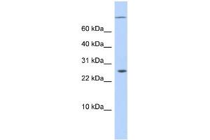 WB Suggested Anti-ARID5A Antibody Titration:  0. (ARID5A antibody  (N-Term))