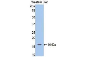 Western blot analysis of the recombinant protein. (Neuropilin 1 antibody  (AA 147-265))
