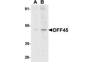 Western Blotting (WB) image for anti-DNA Fragmentation Factor, 45kDa, alpha Polypeptide (DFFA) (N-Term) antibody (ABIN1031352) (DFFA antibody  (N-Term))