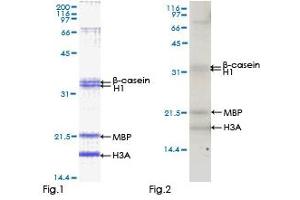 Kinase Activity Assay (KAA) image for Mitogen-Activated Protein Kinase-Activated Protein Kinase 3 (MAPKAPK3) (AA 1-382) protein (GST tag) (ABIN1310326) (MAPKAP Kinase 3 Protein (AA 1-382) (GST tag))
