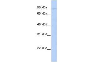 WB Suggested Anti-XYLT2 Antibody Titration:  0. (XYLT2 antibody  (C-Term))