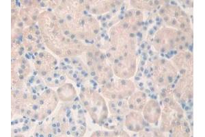 Immunohistochemistry (IHC) image for anti-Muscarinic Acetylcholine Receptor M1 (CHRM1) (AA 210-363) antibody (ABIN7438109)