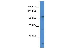 Western Blot showing GABBR2 antibody used at a concentration of 1 ug/ml against Hela Cell Lysate (GABBR2 antibody  (C-Term))