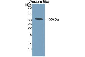 Detection of Recombinant MCP3, Human using Polyclonal Antibody to Monocyte Chemotactic Protein 3 (MCP3) (CCL7 antibody  (AA 24-99))