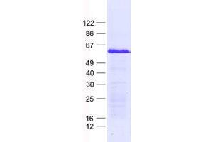 Validation with Western Blot (ZNF596 Protein (His tag))