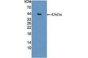 Western blot analysis of recombinant Human HDAC9. (HDAC9 antibody  (AA 23-343))