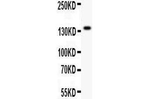 Anti- ZEB2antibody, Western blotting All lanes: Anti ZEB2  at 0. (ZEB2 antibody  (AA 1-200))