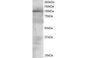 Western Blotting (WB) image for Vav 2 Guanine Nucleotide Exchange Factor (VAV2) peptide (ABIN370136)