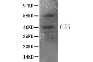 Anti-CCR5 antibody, IHC(P)All lanes: Anti CCR5  at 0.