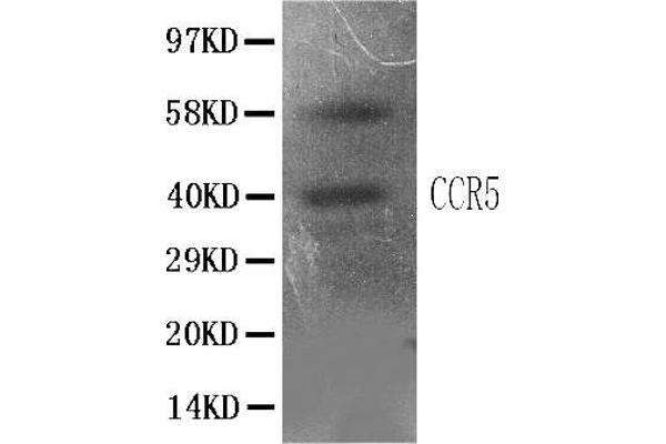 CCR5 Antikörper  (N-Term)