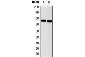 Western blot analysis of STAT5 expression in HeLa (A), A431 (B) whole cell lysates. (STAT5A antibody  (Center))
