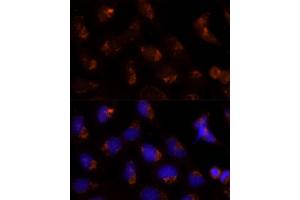 Immunofluorescence analysis of U-2 OS cells using SEC14L2 Polyclonal Antibody (ABIN6132639, ABIN6147484, ABIN6147485 and ABIN6214889) at dilution of 1:100 (40x lens). (SEC14L2 antibody  (AA 60-270))
