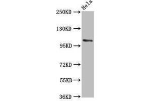 Western Blot Positive WB detected in: Hela whole cell lysate All lanes: PAM antibody at 5.