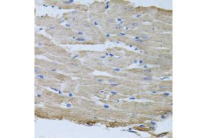 Immunohistochemistry of paraffin-embedded rat heart using TARS antibody (ABIN5974207) at dilution of 1/100 (40x lens). (TARS antibody)