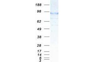 Validation with Western Blot