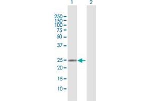 Western Blot analysis of RAB37 expression in transfected 293T cell line by RAB37 MaxPab polyclonal antibody. (RAB37 antibody  (AA 1-223))