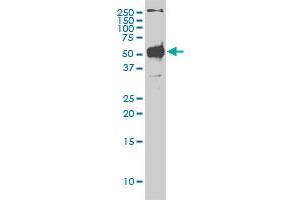 STK38 monoclonal antibody (M01), clone 2G8-1F3 Western Blot analysis of STK38 expression in Hela S3 NE .