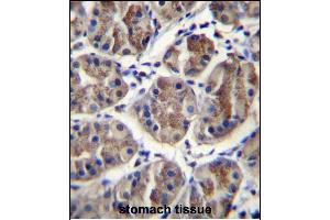 Immunohistochemistry (Paraffin-embedded Sections) (IHC (p)) image for anti-Eukaryotic Translation Initiation Factor 3 Subunit A (EIF3A) (AA 1219-1247), (C-Term) antibody (ABIN656879)