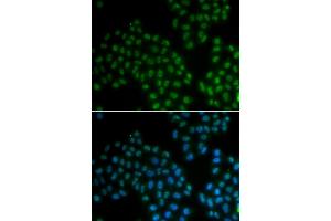 Immunofluorescence analysis of A549 cells using SOX2 antibody. (SOX2 antibody)