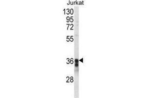Western blot analysis of TM173 Antibody (C-term) in Jurkat cell line lysates (35 µg/lane). (STING/TMEM173 antibody  (C-Term))