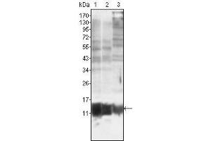 Western Blot showing S100A10/P11 antibody used against MCF-7 (1), HepG2 (2) and Hela (3). (ENDOU antibody)
