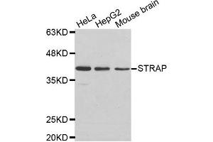 Western Blotting (WB) image for anti-Serine/threonine Kinase Receptor Associated Protein (STRAP) antibody (ABIN1876993) (STRAP antibody)