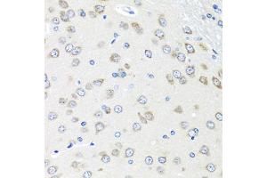 Immunohistochemistry of paraffin-embedded rat brain using PIAS3 antibody (ABIN5974247) at dilution of 1/100 (40x lens).