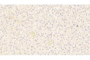 Detection of C4B in Human Liver Tissue using Polyclonal Antibody to Complement C4-B (C4B)