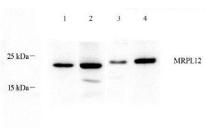 Western blot analysis of MRPL12 (ABIN7074638) at dilution of 1: 1000,Lane 1: Mouse stomach tissue lysate,Lane 2: Mouse colon tissue lysate,Lane 3: Rat breast tissue lysate,Lane 4: Rat stomach tissue lysate