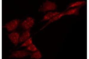 ABIN6275138 staining HeLa by IF/ICC. (GABRA6 antibody  (N-Term))