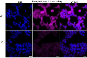 anti-Phospholipase A2-Activating Protein (PLAA) antibody