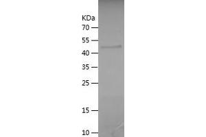 CCDC40 Protein (AA 5-194) (His-IF2DI Tag)