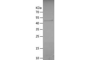 CCDC40 Protein (AA 5-194) (His-IF2DI Tag)