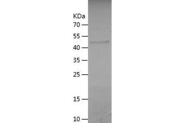 CCDC40 Protein (AA 5-194) (His-IF2DI Tag)