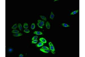 Immunofluorescent analysis of HepG2 cells using ABIN7155229 at dilution of 1:100 and Alexa Fluor 488-congugated AffiniPure Goat Anti-Rabbit IgG(H+L) (HIATL1 antibody  (AA 450-506))