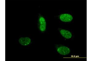 Immunofluorescence of monoclonal antibody to CRSP6 on HeLa cell. (MED17 antibody  (AA 551-651))
