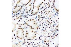 Immunohistochemical analysis of HRP2 staining in human stomach formalin fixed paraffin embedded tissue section. (HDGFRP2 antibody)