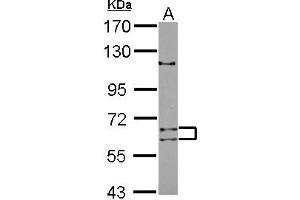 Western Blotting (WB) image for anti-Adenosine Deaminase Domain Containing 1 (Testis-Specific) (ADAD1) (AA 1-307) antibody (ABIN1496470) (ADAD1 antibody  (AA 1-307))