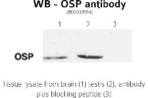 Image no. 2 for anti-Claudin 11 (CLDN11) (C-Term) antibody (ABIN346949) (Claudin 11 antibody  (C-Term))