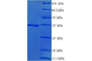 DAND5 Protein (AA 23-189) (His-SUMO Tag)