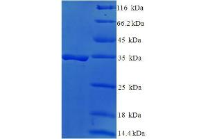 SDS-PAGE (SDS) image for DAN Domain Family, Member 5 (DAND5) (AA 23-189) protein (His-SUMO Tag) (ABIN5711678) (DAND5 Protein (AA 23-189) (His-SUMO Tag))
