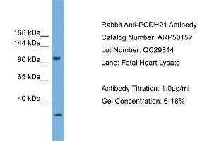 WB Suggested Anti-PCDH21  Antibody Titration: 0. (PCDH21 antibody  (N-Term))