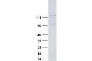 Validation with Western Blot (VWA5B1 Protein (Myc-DYKDDDDK Tag))