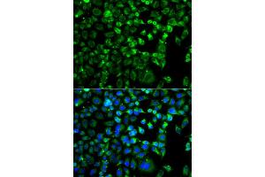 Immunofluorescence analysis of A549 cells using ZAK antibody. (ZAK antibody)
