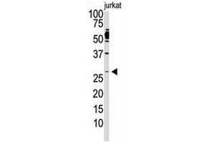 Image no. 1 for anti-Dickkopf 2 Homolog (DKK2) (C-Term) antibody (ABIN357070) (DKK2 antibody  (C-Term))